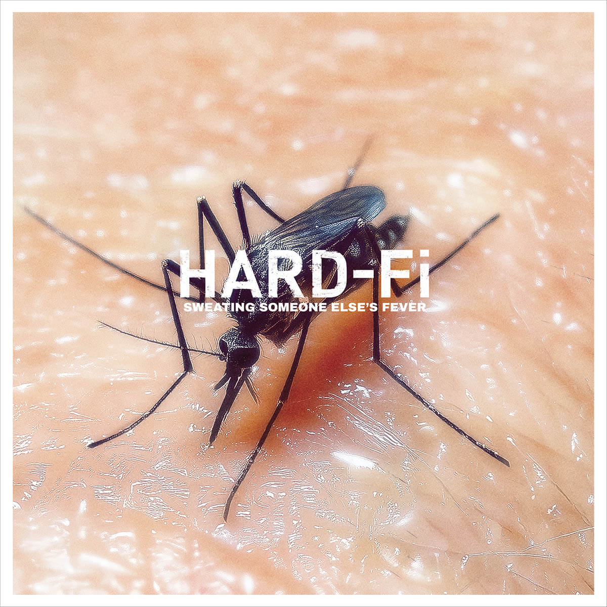 Hard-Fi『Sweating Someone Else’s Fever』